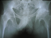 coimbatore-orthopaedic-joint-replacement-maternity-child-welfare-centre-india